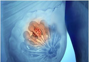 乳房有硬塊正常嗎？乳房有腫塊怎么回事？