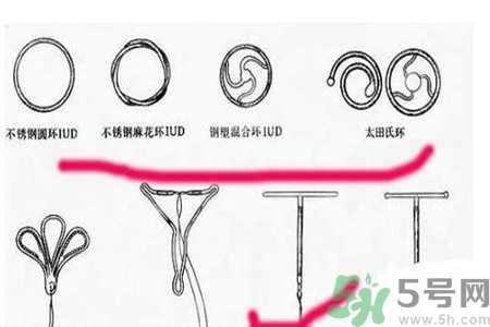 避孕的辦法有什么？避孕的方法有哪些？