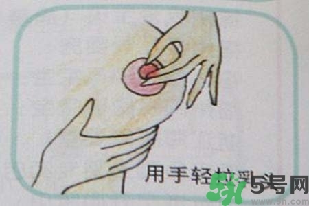 乳頭內(nèi)陷怎么矯正？乳頭內(nèi)陷矯正方法是什么？