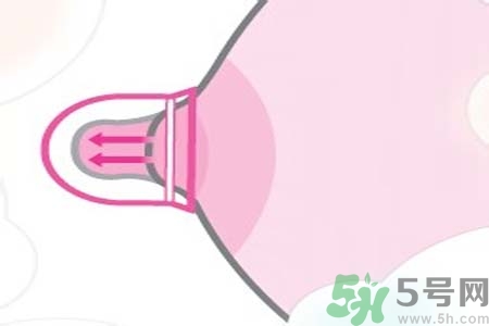 乳頭內(nèi)陷能不能喂奶？乳頭凹陷怎樣哺乳？
