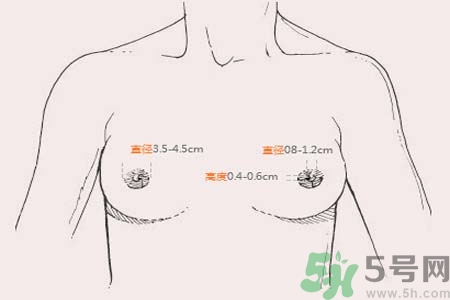 乳頭內(nèi)陷能不能喂奶？乳頭凹陷怎樣哺乳？