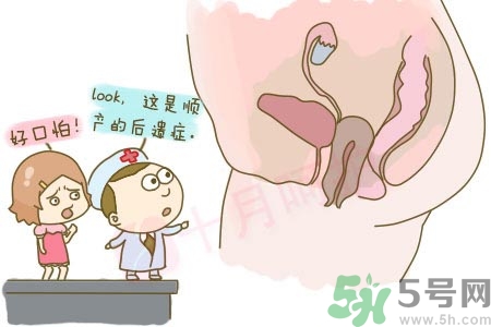 陰道松弛是什么？陰道松弛的癥狀有哪些？