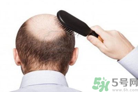 男性衰老的年齡段是什么？各年齡段男性抗衰老法則