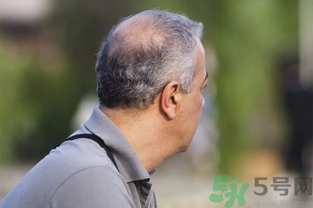 男性更年期的表現(xiàn)有哪些？怎么判斷男性更年期？