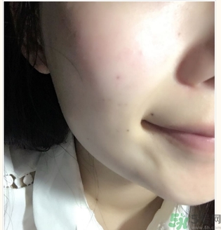 麗得姿面膜適合孕婦可以用嗎？麗得姿面膜哪些孕婦可以用？