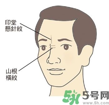耳垂上有豎紋是怎么回事？山根有橫紋是什么?。?></p><h3>山根</h3><p>鼻尖是臉部最高的部位，就像山峰一樣，而位於兩眼內側眼頭之間的鼻梁低處，是鼻子開始要隆起的地方，相對於鼻子高度最低，所以稱為「山根」，它與心臟關系最密切。正常的山根，高度應該與鼻子和面部的比例相合，而且要有隆起的樣子，光滑無橫紋，沒有青筋。</p><p>許多壯年猝死的人，如人稱科技游俠的溫世仁先生（腦干出血），藝人戎祥、馬兆駿（心肌梗塞）等，他們的山根都比較低陷，幾乎與兩側的眼頭一樣高。</p><p>●山根低陷或出現(xiàn)橫向細紋：山根低陷除非是外傷，否則通常是先天的結構；山根橫紋則常在身體使用多年、身心壓力大的中年以後出現(xiàn)，而且多兼有皺眉的習慣。</p><p>●山根青筋：較常出現(xiàn)在小孩子身上，表示曾受驚嚇，心神不安，睡覺時多會翻覆，情緒比較不太穩(wěn)定。</p><p style=