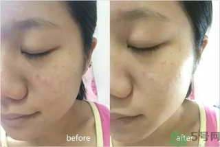 rilastil面膜使用方法 維納斯蒂爾面膜怎么用？