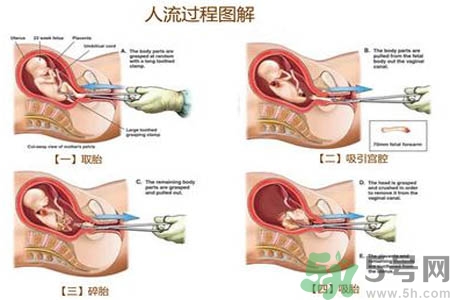 人流后怎么調(diào)養(yǎng)身體？人流后飲食需注意什么？