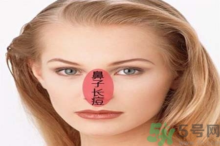鼻翼長痘痘怎么辦？鼻翼長痘解決方法有哪些？