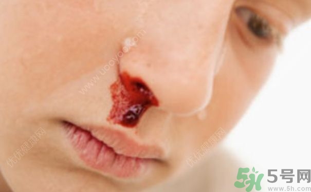 15歲男孩可以刮胡子嗎？15歲男孩經(jīng)常流鼻血怎么回事？