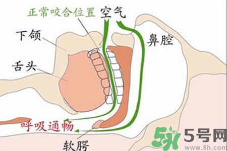 鼻子紅是什么原因？鼻子紅怎么辦？
