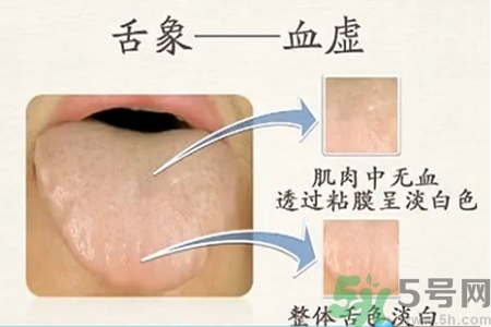 血虛的癥狀是什么？血虛的表現(xiàn)有哪些？