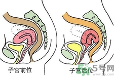 ?子宮移位怎么治療？子宮移位能懷孕嗎？