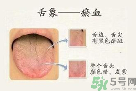 血瘀體質(zhì)吃什么？血瘀體質(zhì)怎么調(diào)理？