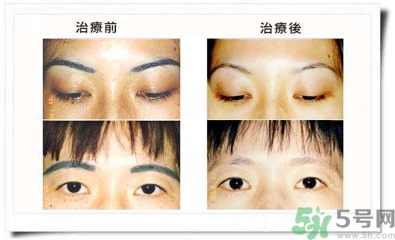 紋眉毛有什么危害？紋眉后注意事項