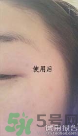 dr.jart適合什么年齡層？蒂佳婷適合年齡