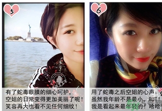 蛇毒眼膜孕婦可以用嗎？ 日本spa蛇毒眼膜孕婦能用嗎？
