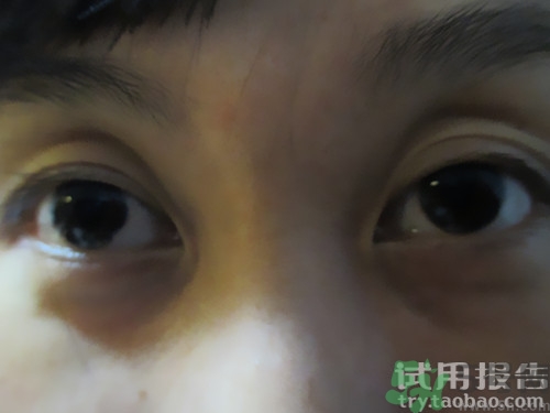 蛇毒眼膜效果怎么樣？spa蛇毒眼膜紅色好用嗎？