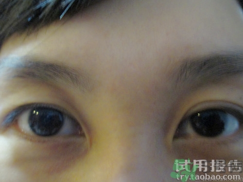 蛇毒眼膜效果怎么樣？spa蛇毒眼膜紅色好用嗎？