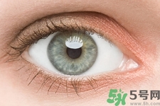 黑眼圈是怎么形成的？黑眼圈是什么原因引起的？