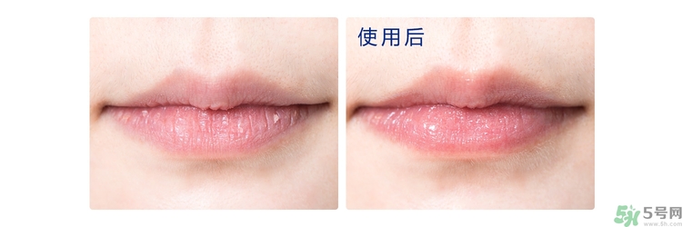 碧唇小藍(lán)罐唇膏孕婦可以用嗎？blistex碧唇小藍(lán)罐專柜價(jià)格