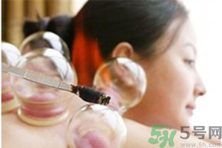 月經(jīng)可以拔火罐嗎？經(jīng)期可以拔火罐嗎？