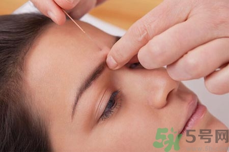 針灸一次要扎多長時(shí)間？針灸可以幾天做一次？