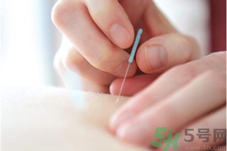 針灸一次要扎多長時(shí)間？針灸可以幾天做一次？