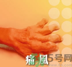 骨關(guān)節(jié)炎能治好嗎？骨關(guān)節(jié)炎平時(shí)注意事項(xiàng)