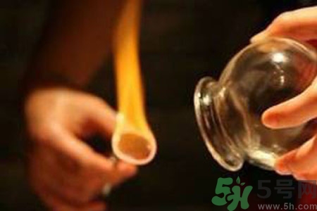 老人能在家拔火罐嗎？老年人拔火罐需要注意什么？