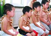 小孩可以拔罐嗎？寶寶能拔火罐嗎？