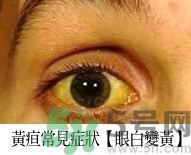 上腹部不舒服有時疼痛會不會是胰臟癌？