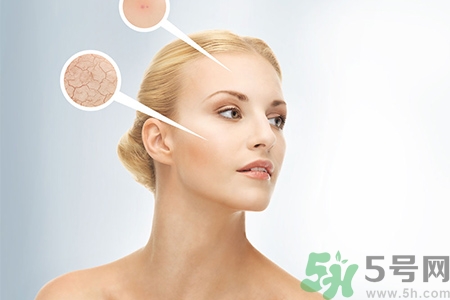 甘油會(huì)堵塞毛孔嗎？甘油堵塞毛孔怎么辦？