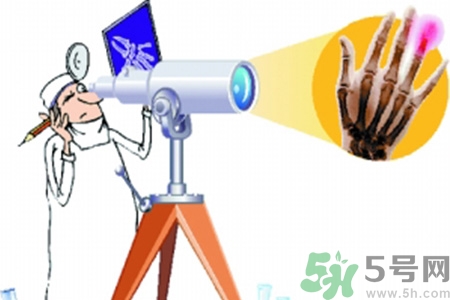 什么年齡測骨齡最好？如何測骨齡？