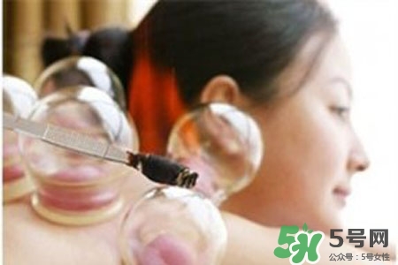 拔罐放血對身體好嗎？拔罐放血有什么好處？