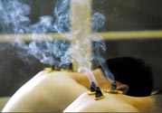 落枕能艾灸嗎？艾灸治療落枕有用嗎？