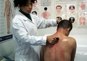 刮痧后什么顏色才健康？刮痧顏色反映的病癥