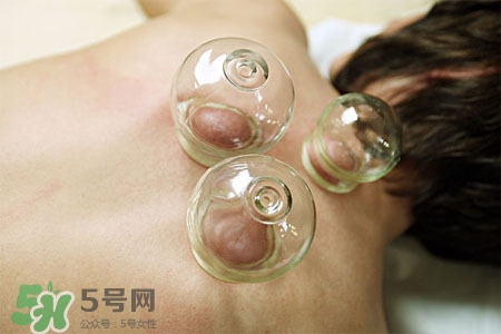 拔火罐后皮膚癢正常嗎？拔火罐后皮膚癢什么原因？