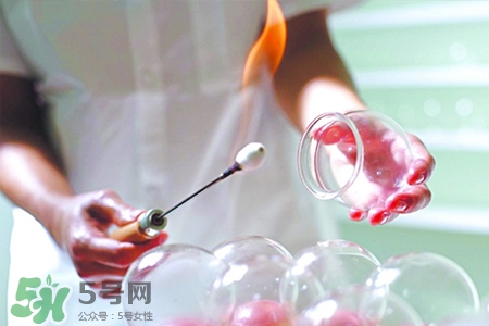 冬天拔罐后多久能洗澡？警惕冬季拔罐后不宜立即洗澡