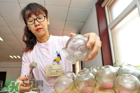 針灸火罐后多久能洗澡？針灸火罐后能馬上洗澡嗎？