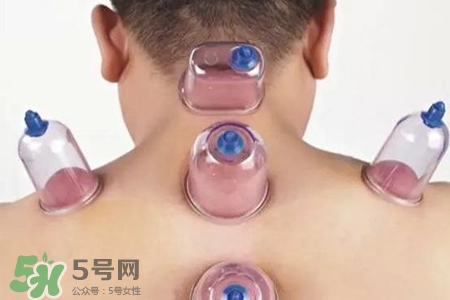 拔罐后可以喝酒嗎？拔罐后多久能喝酒？