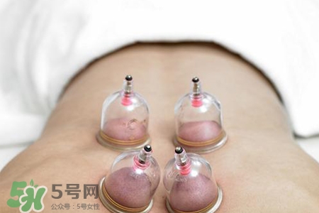 拔罐后可以貼膏藥嗎？拔罐后多久能貼膏藥？
