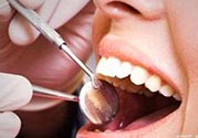 拔牙之后可以吃藥嗎？拔牙之后要不要吃藥？
