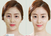 skin1004是什么牌子？skin1004屬于什么檔次