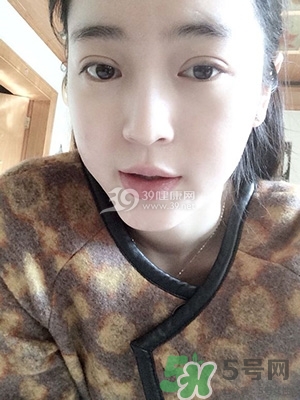 什么是定點雙眼皮？定點雙眼皮多少錢？