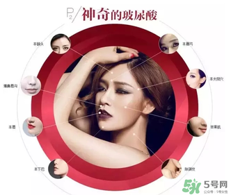 喬雅登是哪個國家的？喬雅登玻尿酸哪個國家？