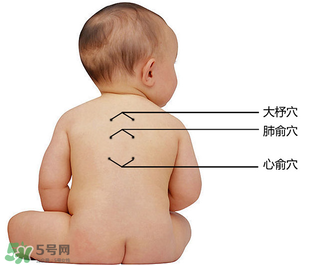 三九貼能治什么病？三九貼的作用