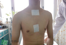 三九貼怎么貼？三九貼的貼法