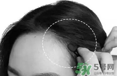 發(fā)際線高適合什么發(fā)型？發(fā)際線高怎么辦