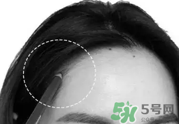 發(fā)際線高適合什么發(fā)型？發(fā)際線高怎么辦